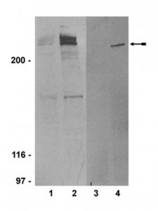 Anti-phospho-ATM (Ser1981) Antibody, clone 10H11.E12 