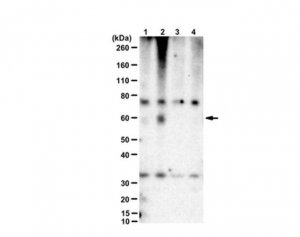 Anti-phospho-CaMKII beta (Ser331) 