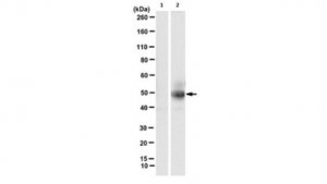 Anti-phospho-cytokeratin-18 (K18) (Ser33) Antibody, clone IB4 