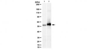 Anti-phospho-cytokeratin-8 (K8) (Ser431) Antibody, clone 5B3 