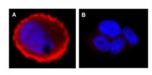 Anti-phospho-erbB-2/HER-2 (Tyr1248) Antibody 