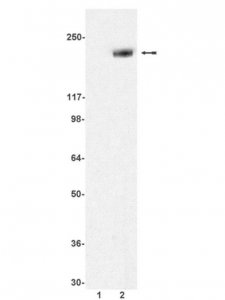 Anti-phospho-erbB-2/HER-2 (Tyr1248) Antibody 