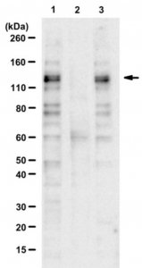 Anti-phospho-MDA-5 (Ser104) 