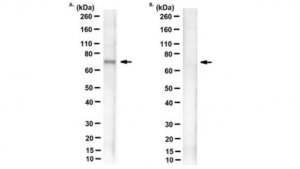 Anti-phospho-SAMHD1 (Thr592) Antibody, clone T592P 