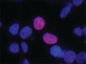 Anti-PLAGL1 antibody produced in rabbit 