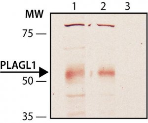 Anti-PLAGL1 antibody produced in rabbit 