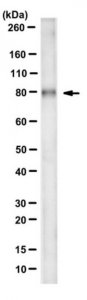 Anti-Plakophilin 1 Antibody, clone 10B2 
