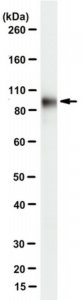 Anti-Plakophilin-3 Antibody, clone 7F6 