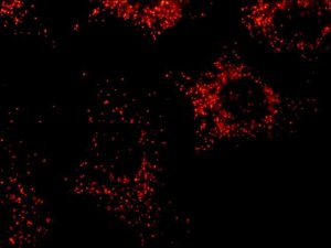 Anti-PMP70 antibody, Mouse monoclonal 