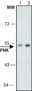 Anti-PNK antibody ,Mouse monoclonal 