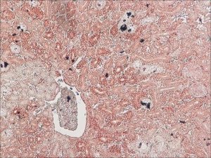 Anti-Podocin, Mouse monoclonal 
