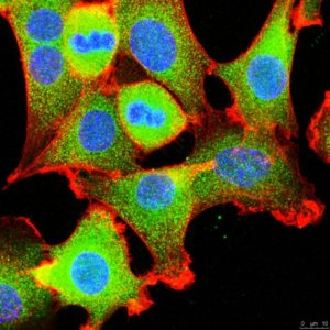 Anti-Polo-like kinase-1 