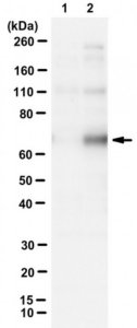 Anti-Polo-like kinase-1 