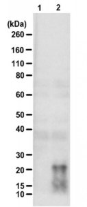 Anti-poly-(QAGR) 