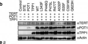 Anti-POT1 antibody produced in rabbit 
