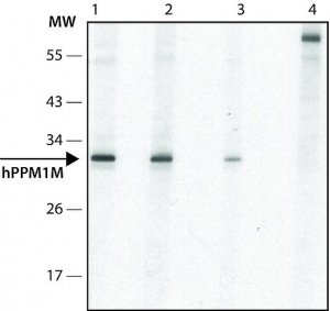 Anti-PPM1M (C-terminal) antibody produced in rabbit 