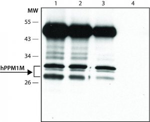 Anti-PPM1M (C-terminal) antibody produced in rabbit 