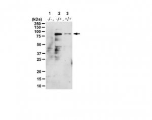 Anti-PRDM9 