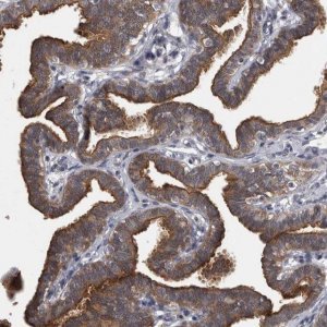 Anti-PRKCI antibody produced in rabbit 