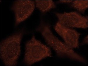 Anti-Pro LC3C antibody, Mouse monoclonal 