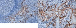 Anti-Properdin Antibody, clone 1G6D2 