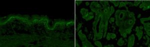 Anti-PTK7 Antibody, clone 31G9 