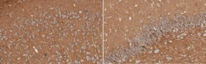 Anti-PTP zeta/Phosphacan 