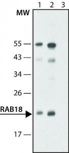 Anti-Rab18 (C-terminal) antibody produced in rabbit 