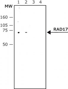 Anti-RAD17 (N-terminal) antibody produced in rabbit 
