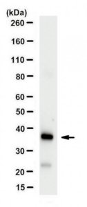 Anti-RANKL Antibody, clone 6A12.1 