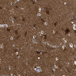 Anti-RAP1GDS1 antibody produced in rabbit 