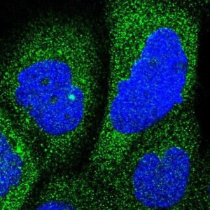 Anti-RAP1GDS1 antibody produced in rabbit 