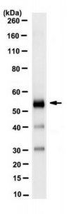 Anti-Retinal Dehydrogenase 1/ALDH1A1 Antibody, clone 16B4.2 