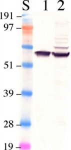 Anti-Retinal Pigment Epithelium 65 Antibody 