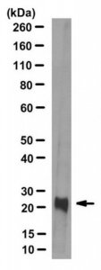 Anti-Retinoschisin Antibody, clone 3R10 