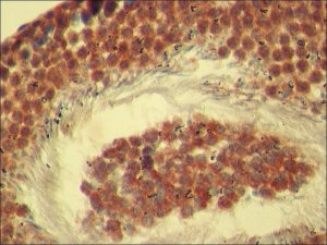 Anti-Rictor antibody produced in rabbit 