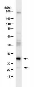 Anti-RINF (CXXC5) 