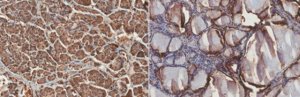 Anti-RKIP Antibody, clone 4A11 