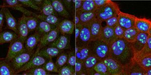 Anti-RRP8 Antibody, clone 5C7.1 