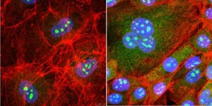 Anti-RRP8 Antibody, clone 5C7.1 