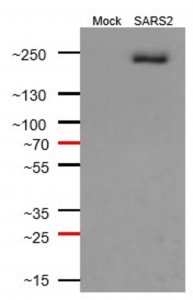 Anti-SARS-CoV-1/2 S Protein Antibody, clone 2B3E5 ZooMAb Mouse Monoclonal 