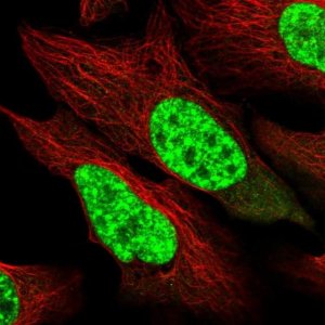 Anti-SART1 antibody produced in rabbit 