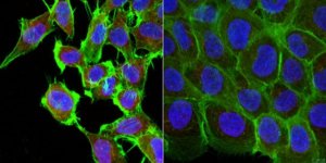 Anti-SCYL1 
