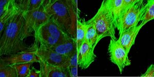 Anti-SCYL1 