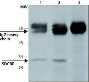 Anti-SDCBP (N-terminal) antibody produced in rabbit 