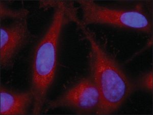 Anti-SDCBP (N-terminal) antibody produced in rabbit 
