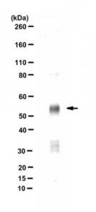 Anti-SETD6 