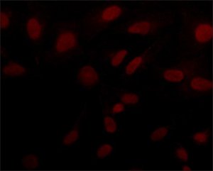 Anti-Sirt6 (N-terminal) antibody produced in rabbit 