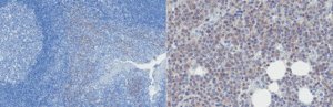 Anti-SLAMF7 (CD319) Antibody, clone 162 