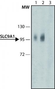 Anti-SLC9A1 antibody produced in rabbit 